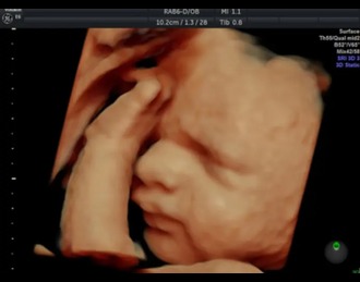 /Content/ServiceImages/3rd T Scan.jpg